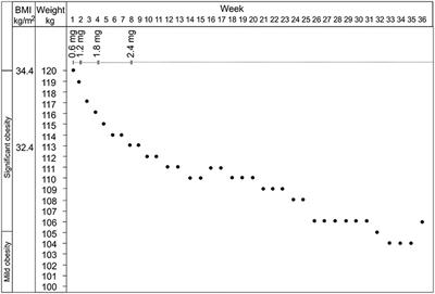 Beneficial Effects of GLP-1 Agonist in a Male With Compulsive Food-Related Behavior Associated With Autism